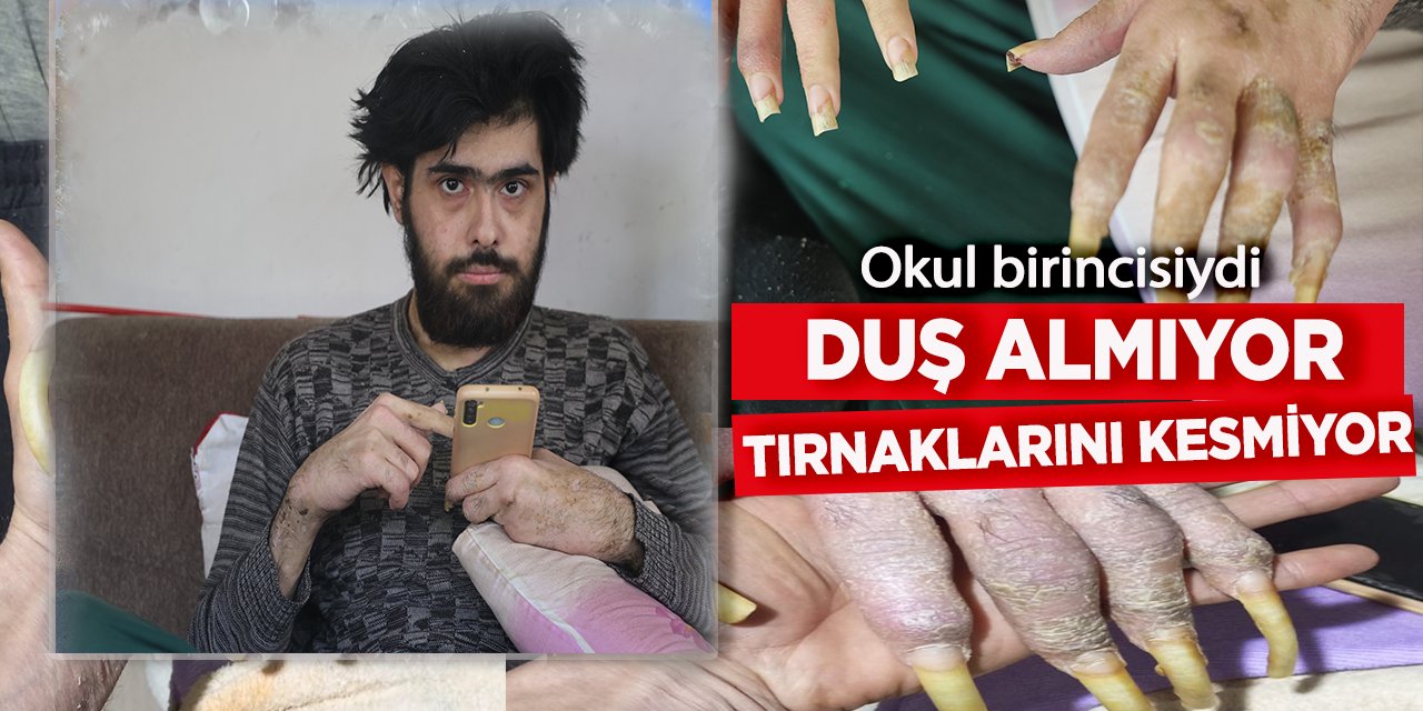 Okul Birincisiydi, Telefona Bağımlı Hale Geldi! 3 Yıldır Evden Çıkmıyor: Duş Almıyor, Tırnaklarını Kesmiyor